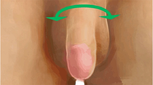 Antes do procedimento